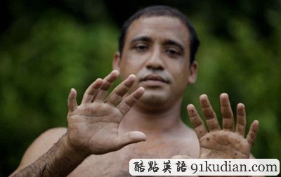 大千世界:古巴驚現(xiàn)24指人